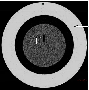 Figure 1. CT image of the phantom surrounded by a 30 cm diameter body annulus (long arrow)