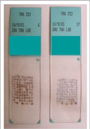 Figure 2 Representative microarray slide. This picture shows the tissue cores from the samples affixed to the tissue microarray slides used in this study.