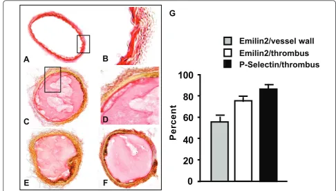 Figure 3 Localization of EMILIN2 in carotids. A, B. Sections from uninjured carotid were immunostained with E185 for EMILIN2