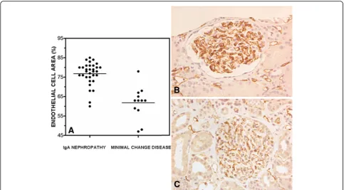Fig. 2 Area occupied by endothelial cells in IgAN and MCD glomerular capillaries. The mean percentage of the total capillary loop area occupiedgroups of biopsies, in MCD the mean was significantly lower than in IgAN (61.83 ± 8.39 versus 76.81 ± 5.89,deviat