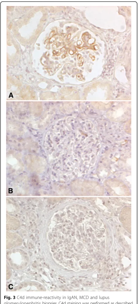 Fig. 3 C4d immune-reactivity in IgAN, MCD and lupusglomerulonephritis biopsies. C4d staining was performed as describedin Materials and Methods