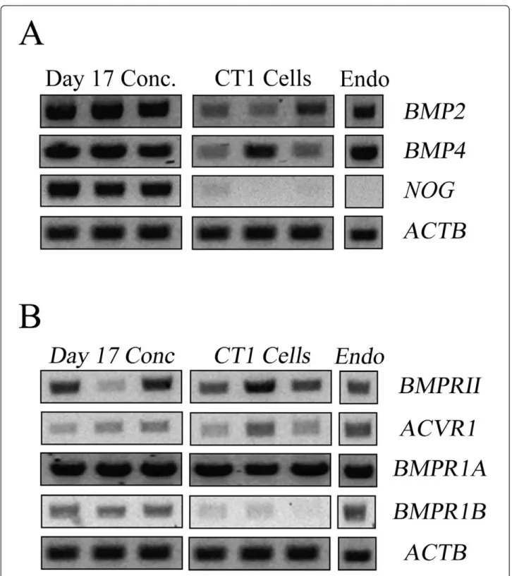 Figure 1 End-point RT-PCR analysis of transcripts for bovine BMP ligands and receptors in the peri-attachment conceptus (day 17 post-insemination), trophoblast cells (CT1) and endometrium (Endo.)