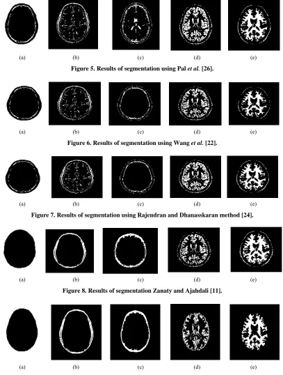 Figure 7. Results of segmentation using Rajendran and Dhanasskaran method [24]. 