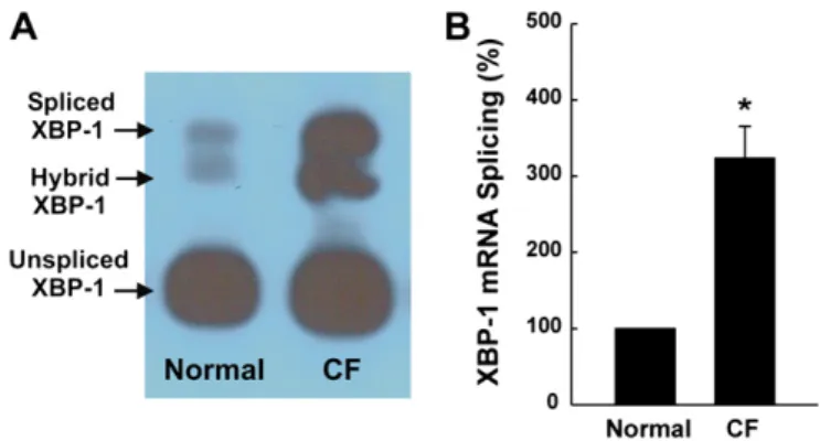 Figure 1. Native cystic fibrosis (CF) human bronchial epithelia exhibit increased activation of X-box binding protein-1 (XBP-1)