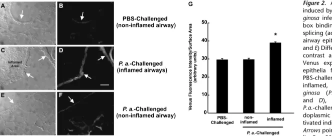 Figure 2. Airway inflammation induced by Pseudomonas  aeru-ginosa infection promotes  X-box binding protein-1 mRNA splicing (activation) in murine airway epithelia in vivo
