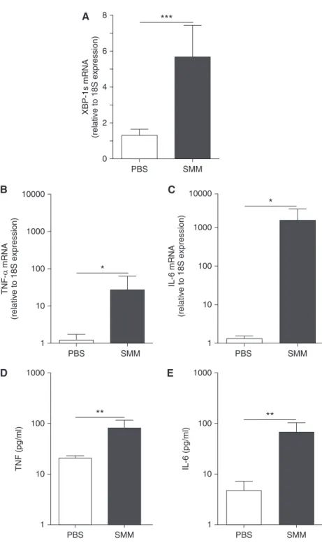 Figure 7. The increased X-box–binding protein-1 mRNA splicing (XBP-1s) and the robust inflammation of cystic fibrosis (CF) alveolar macrophages reflect an acquired response to the luminal infectious and inflammatory milieu of CF airways