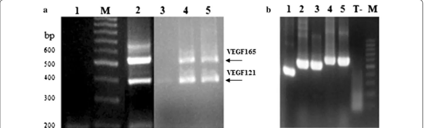 Fig. 1  Analysis of electrophoretic profiles. a Agarose gel profile of products resulting from PCR amplification of the VEGF transcripts present in 