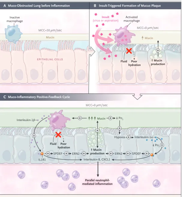Figure 3.  Muco-Inflammatory Positive-Feedback (“Vicious”) Cycles in Muco-Obstructive Disease.