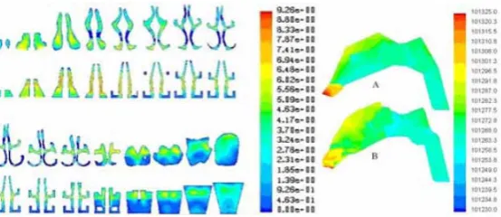 Figure 6. Comparison of velocity (left) and pressure (right) distribution be-tween characteristic model and origin one of nasal cavity