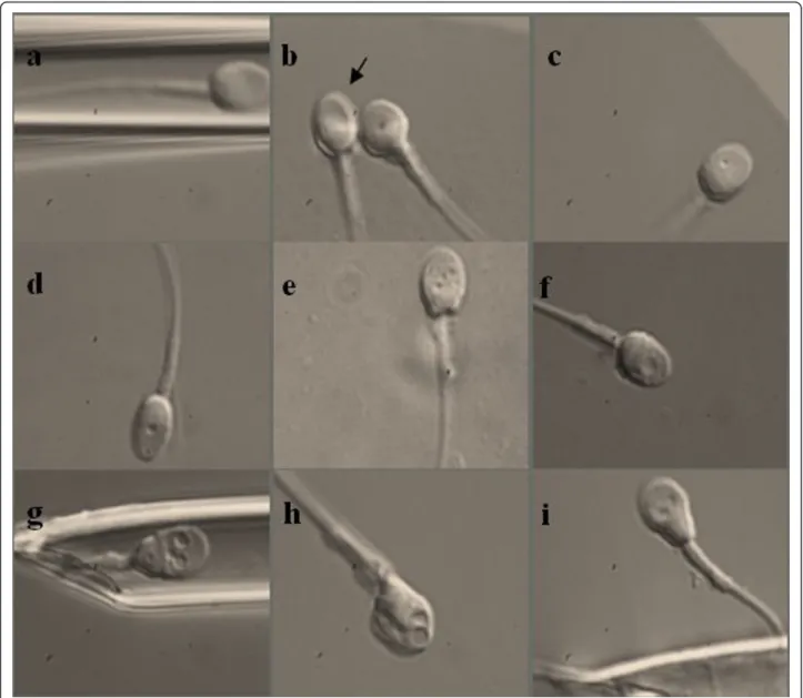 Figure 1 Classification of spermatozoa selected at 6,000 × magnification into 3 different categories