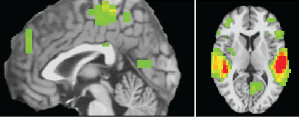 Figure 1. Empirically determined regions displaying condition (criticism/rest) 6 scan interactions, p,.005, 30 voxels contiguity.doi:10.1371/journal.pone.0044412.g001