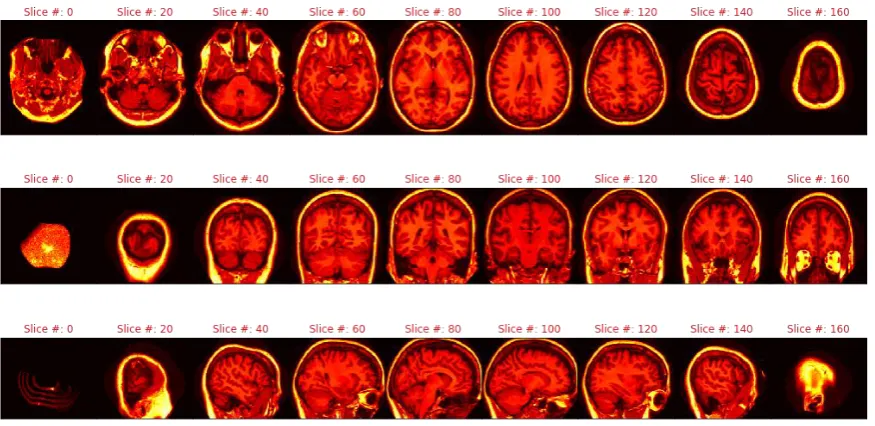 Figure 1 illustrates the sagittal, axial, and coronal viewpoints as well as the resolution used in this 