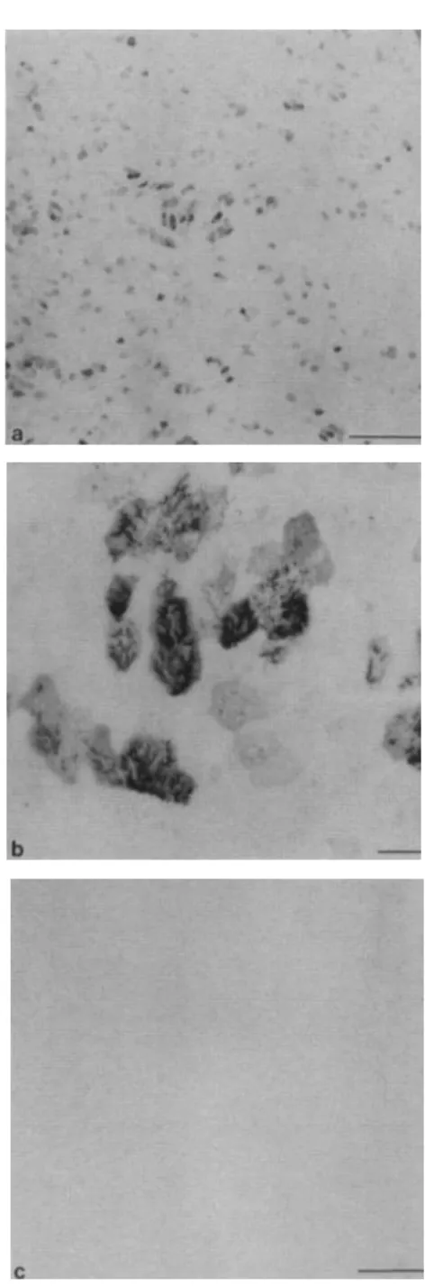 Figure 1. Immunostaining of air-liquid interface cultures with mAb RTE3. Interface cultures of RTE cells were fixed, immunostained with mAb RTE3, and whole-mounted