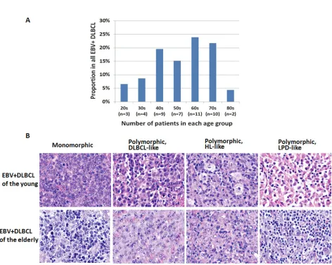table 3: expression of micrornAs in patients with epstein-barr virus-positive diffuse large B-cell lymphoma who are ≤50 years and >50 years old