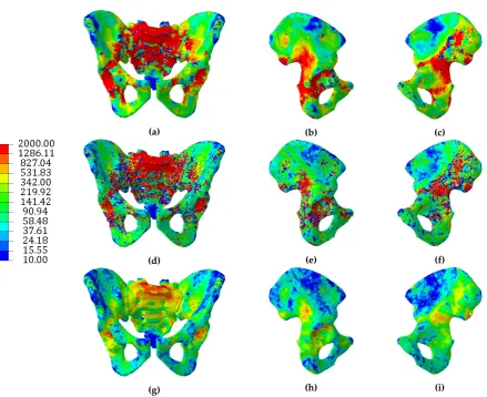 Figure 6. Trabecular elements’ radii distribution (mm) of the structural model. Trabecular elementswith a radius < 0.1mm were excluded for clarity.