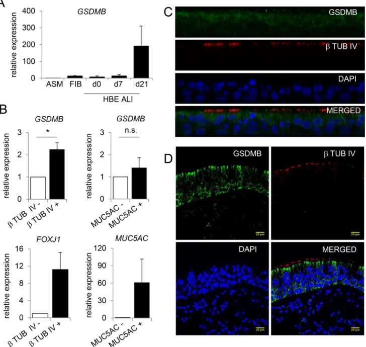 Figure 1. GSDMB expression in airway epithelium