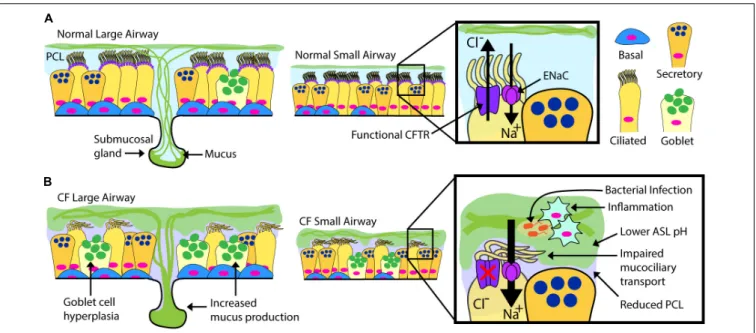 FIGURE 1 | Normal vs. CF Airway. Schematic drawings of normal and CF airways, illustrating selected components of epithelial apical ion transport