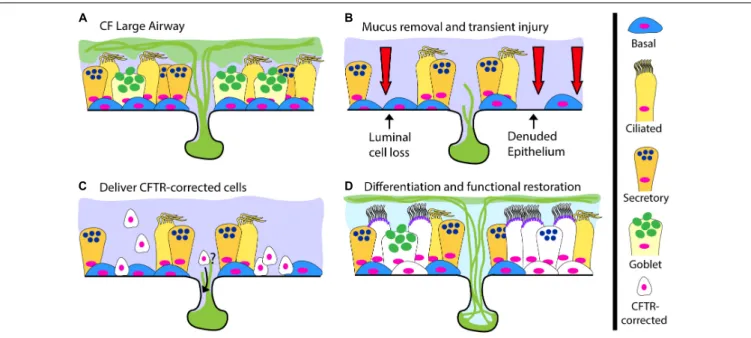 FIGURE 2 | A Cell-Based Therapy Model for CF. (A) The pre-treatment CF large airway. (B–D) A depiction of cell-based therapy in three steps: (B) Mucus removal and transient preconditioning of the airway epithelium, potentially requiring luminal epithelial 
