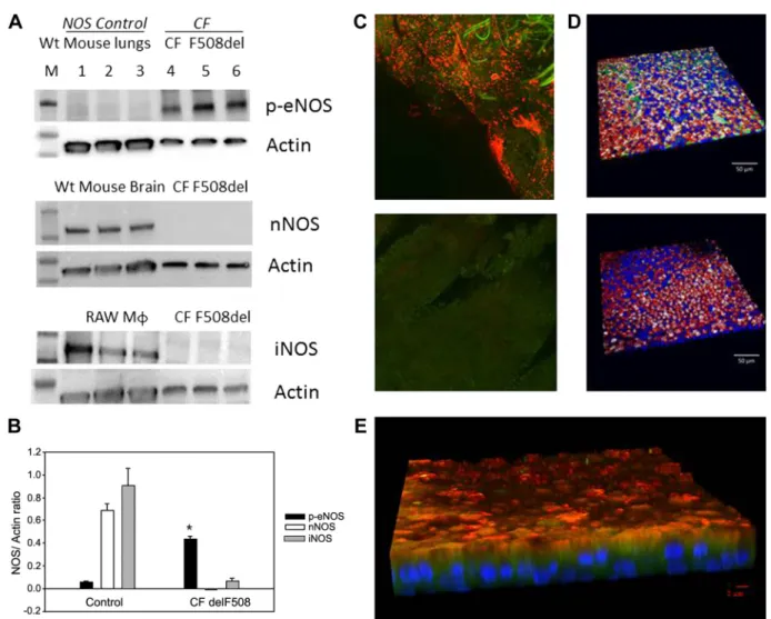 Fig. 2. Endothelial nitric oxide synthase (eNOS) expression in human airway pseudostratified epithelium