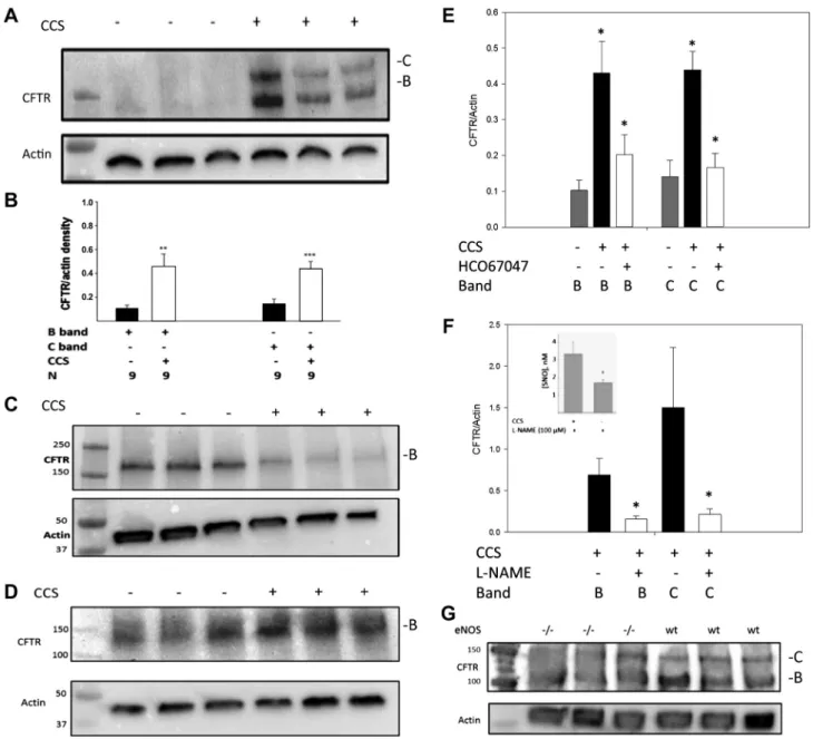 Fig. 5. Cyclic compressive stress (CCS) increases CFTR maturation in human airway epithelial cells, an effect requiring cilia, transient receptor potential vanilloid (TRPV4), and nitric oxide synthase (NOS)