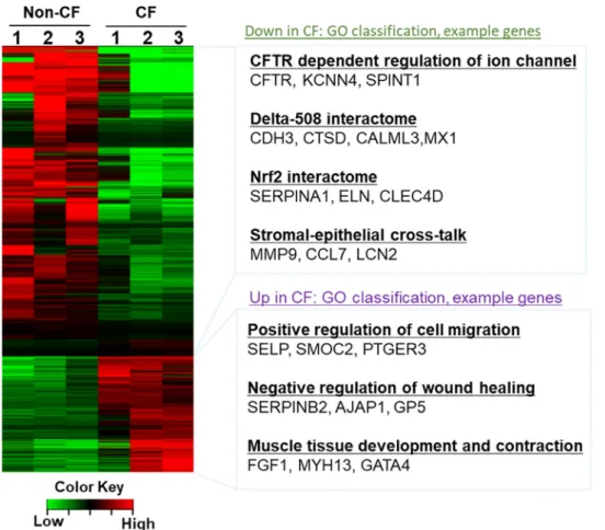 Fig.  3. Differential gene expression analysis of CF Fibrocytes shows ﬁbrosis-associated transcriptional changes in CF lungs