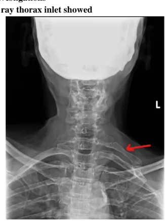 Fig 1: X Ray Thoraxic Inlet 