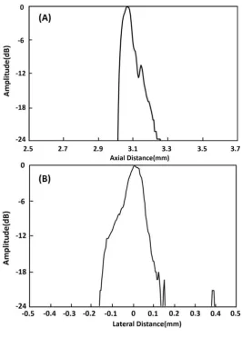 Figure 10. (A) Axial and (B) lateral line spread functions for the second wire of the wire phantom