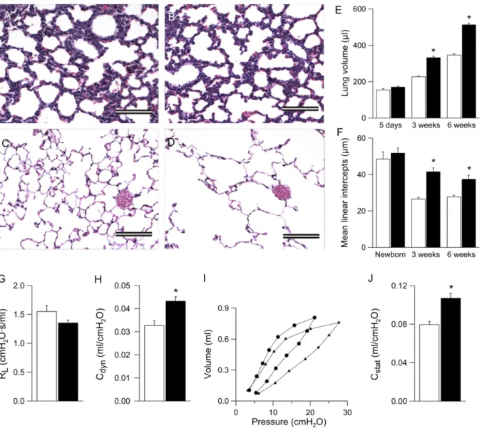 Figure 9. Development of emphysema in b-epithelial Na 1 channel (bENaC)-overexpressing mice