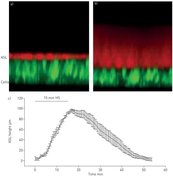 FIGURE 1 a) XZ-confocal image of a cross-section of airway epithelial cells stained with calcein, a fluorescent green dye, and airway surface liquid (ASL) stained with Texas red dextran, a cell-impermeable red dye;