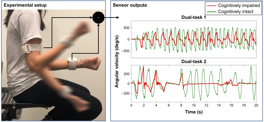 Figure 1 UeF experimental setup, sensor outputs and parameters: (left) Wearable motion sensors were used to capture forearm and upper-arm motion, and ultimately the elbow angular velocity during rapid elbow flexion/extension