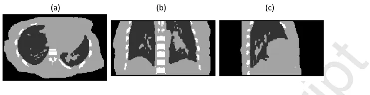 Fig. 3Accepted Manuscript. Transverse (a), coronal (b) and sagittal (c) images of the simulated attenuation map corresponding to a single gate.
