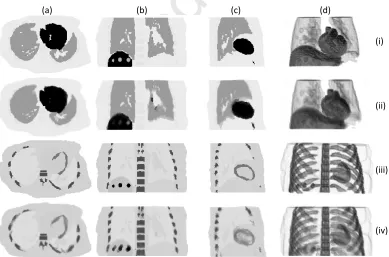 Fig. 5Accepted Manuscriptpoints during the simulated dynamic [late time frame (iii-iv) (t = t