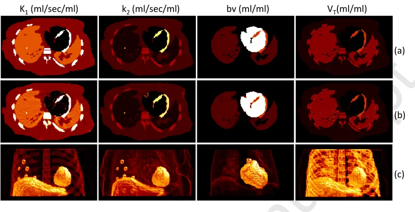 Fig. 8Accepted Manuscriptsimulated single gate dynamic [. Parametric images of K1, k2, bv and VT (a) simulated and (b) estimated (using GLLS) following 3D reconstruction of the 15O]H2O phantom dataset