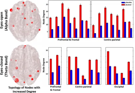 Figure 4. Topologies of the nodes with increased degree following inebriation for a representative threshold of 0.35