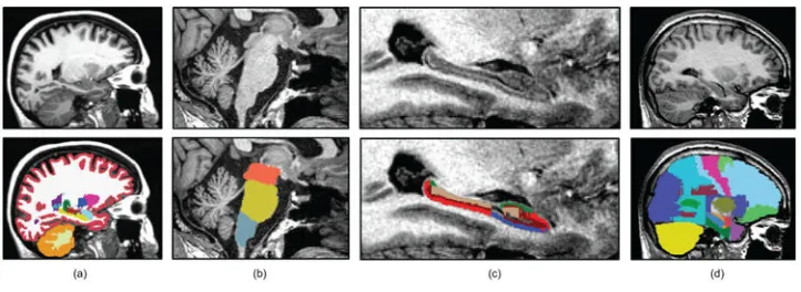 Figure 6. Sample sagittal slices of the four datasets used in this study, with manual annotations 