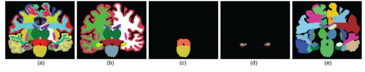 Figure 7. Protocol functions: (a) sagittal slice of a segmentation at the fine label level; (b) effect of 