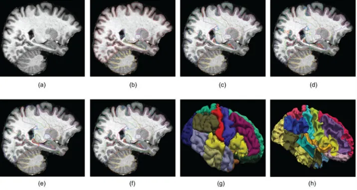 Figure 10. (a) Sagittal slice of a scan from the FreeSurfer dataset. (b) Corresponding manual 