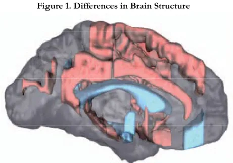 Figure 1. Differences in Brain Structure