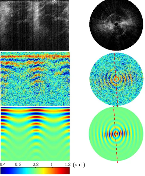 Fig. 4. Intensity (top) and phase retardance images (middle) obtained by CS-PS-OCT from a bovine tendon sample as a function of rotation angle with entire span of 360° and a 1° interval