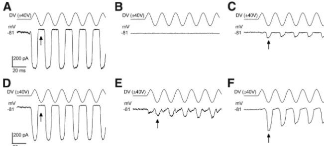 Figure 6.Appearance of the anomalous MET current in normal OHCs following mechanical damage to the hair bundle