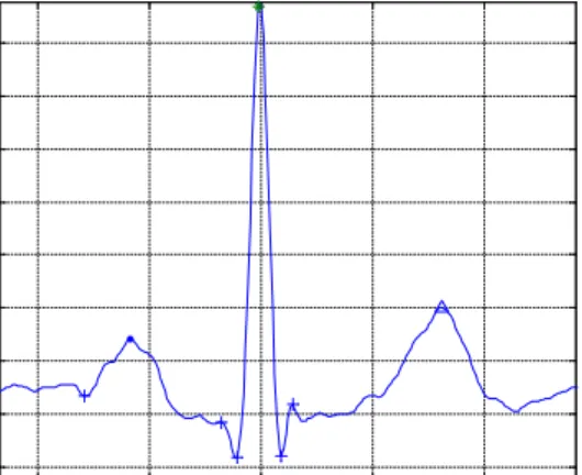 Figure 2.5: Peak Detection 