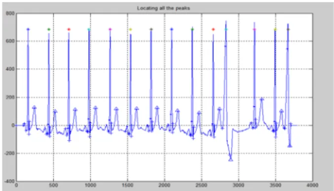 Figure 3.5: Testing Signal #116(PVC) 
