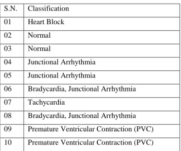 Table 3.2: Arrhythmia Detection from different sample 