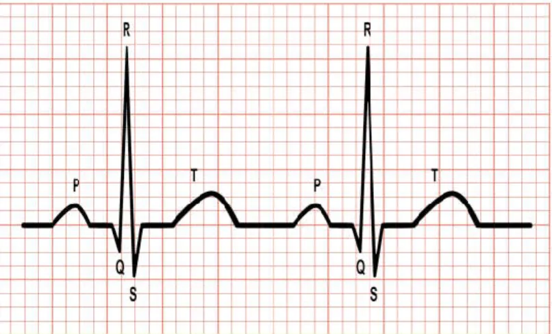 Figure 1.  A two periods of normal ECG wave. The vertical small box represents  the voltage of heartbeat electricity in 0.1 millivolts and the horizontal small 