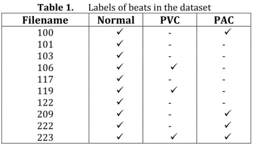 Table 1.  Labels of beats in the dataset 