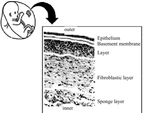 Figure 1. Histological scheme of human amniotic membrane showing its five layers.  