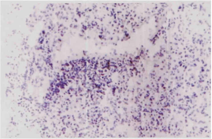 Figure 5.4: MUCl and class I (H2'^) surface expression on DA3-MUC] tumour cells determined by 