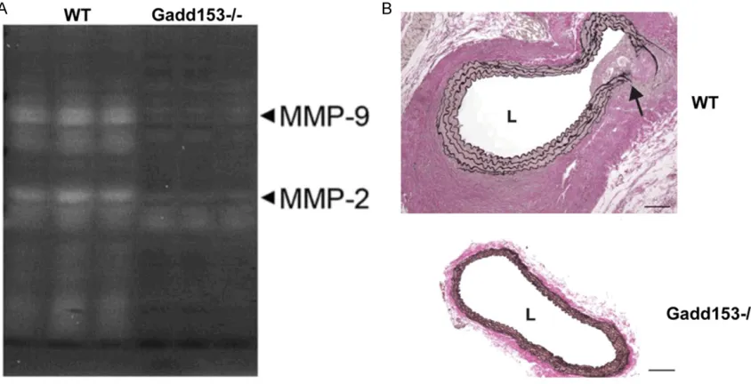 Figure 5. Matrix metalloproteinase (MMP) expression is attenuated in the aortas of Gadd153-/-mice