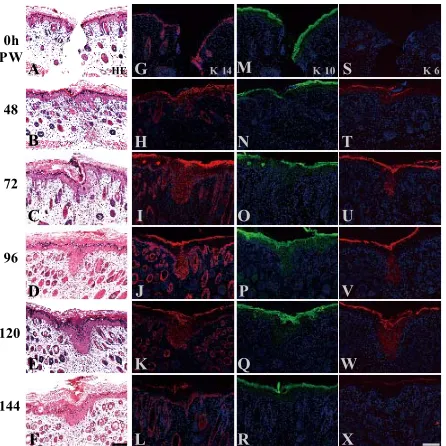 Figure 1. Morphological and immunohistochemical changes in neonatal rat skin wounds during reepithelialization