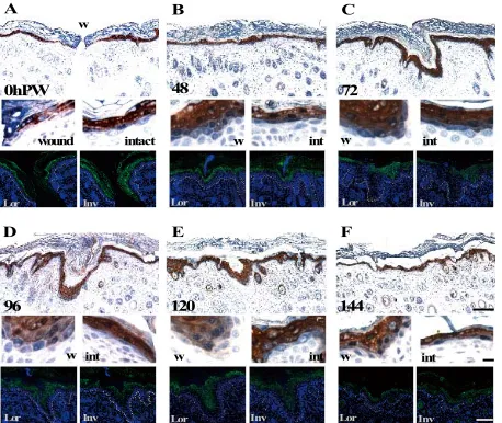 Figure 4. The expression patterns of filaggrin remained unchanged during reepithelialization